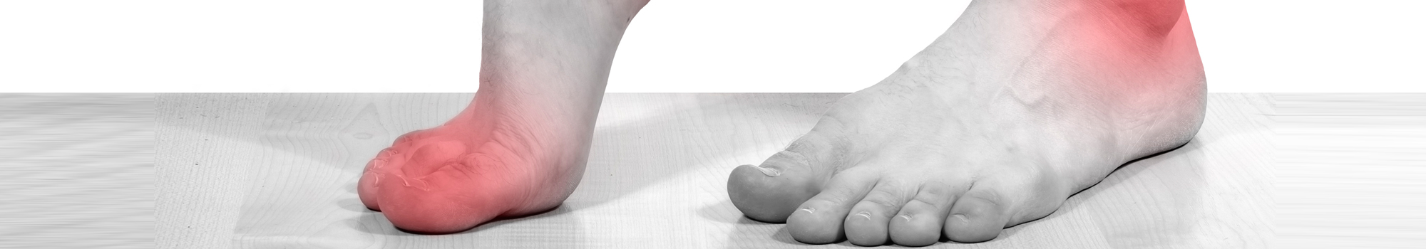 neuropathy